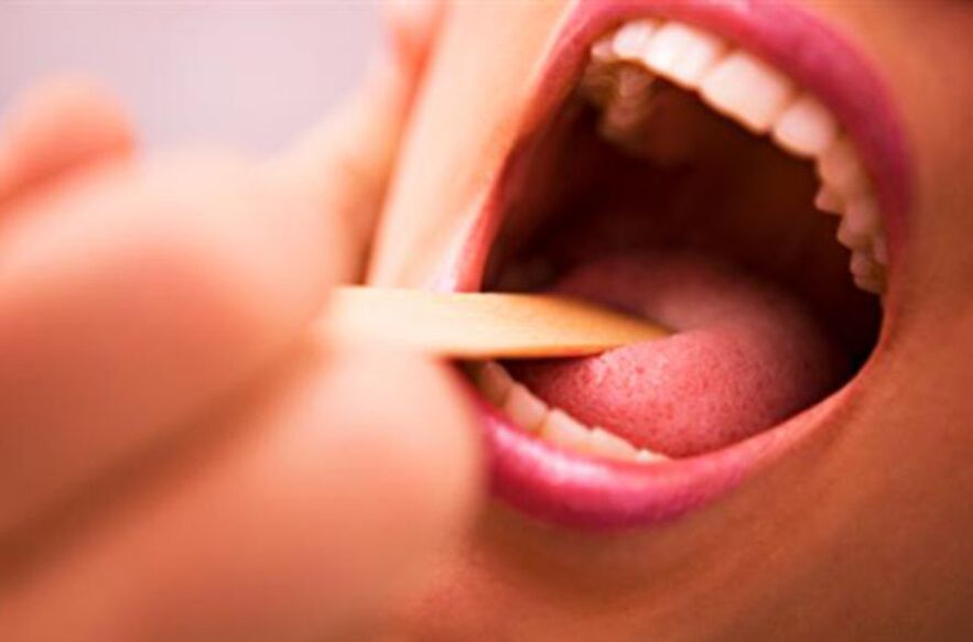 druhy parazitů v lidských ústech